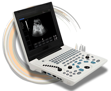 Laptop Ultrasound Diagnostic System
